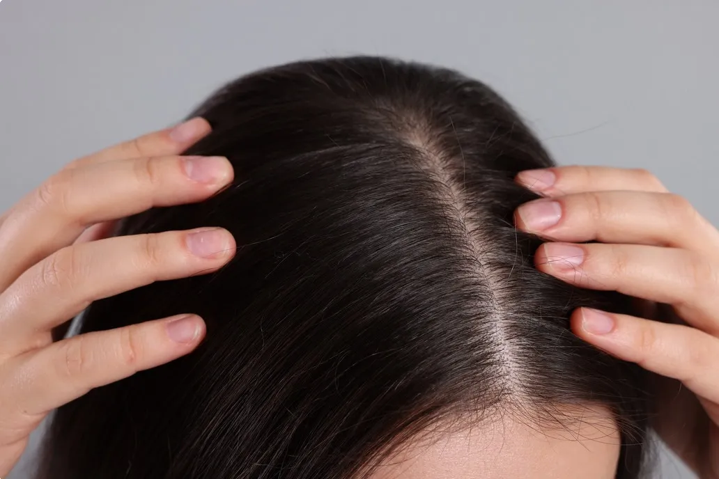 
                                                                                            Pourquoi les cheveux deviennent-ils gras et comment les éviter ? Conseils d'experts
                                            